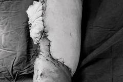 做梦梦见老公截肢了 刚结婚的女人梦见预示什么