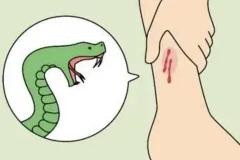 梦见自己被蛇咬了是什么征兆 冬天梦到此梦是吉兆吗