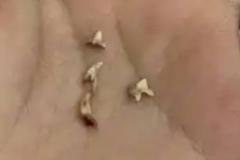 女梦到掉牙吐一堆但是没掉完 做梦梦见掉牙意味着什么