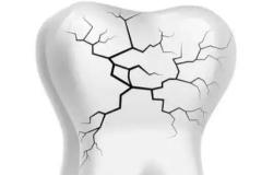梦到牙齿碎了一块一块的 是否暗示现实生活中有困扰