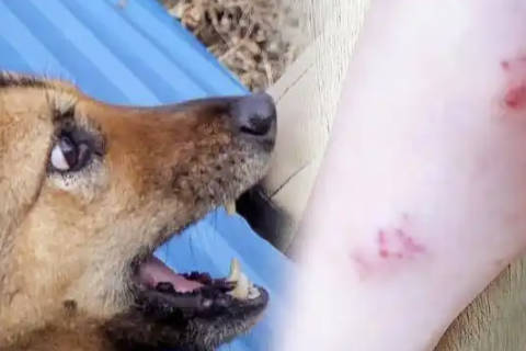 梦见被狗咬了手臂 女人做梦被狗咬好不好