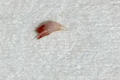 梦见牙齿一摇一扯就掉啦 梦见掉牙真会死人吗