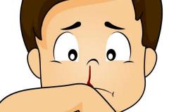 梦见鼻子出血是好事还是坏事 财运会受损吗