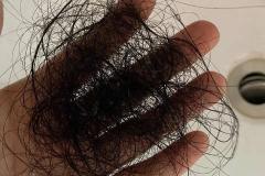 做梦梦到掉头发 女人梦见掉一大把头发