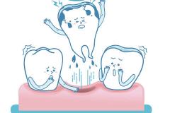 做梦梦到牙齿松动但没掉 女性梦见有何特殊含义